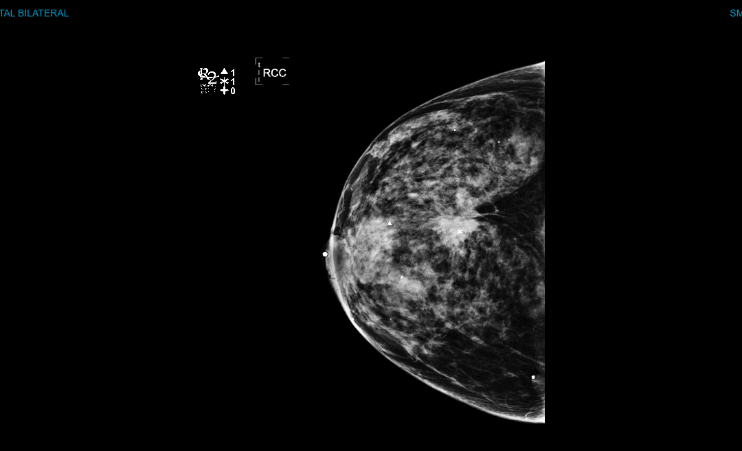 Patient Stories for Sugar Control