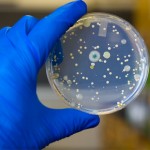 Superbugs are Killing Us